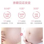 孕婦腹膜